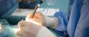 Operasi Retina Mata di Lamongan